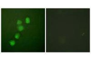 Immunofluorescence analysis of HuvEc cells, using Cyclin E1 (Ab-395) antibody. (Cyclin E1 Antikörper  (Thr395))