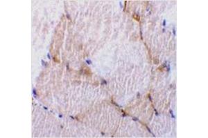 Immunohistochemistry of caspase-7 in rat skeletal muscle tissue with caspase-7 antibody at 10 μg/ml. (Caspase 7 Antikörper  (N-Term))