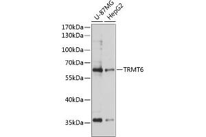 Western blot analysis of extracts of various cell lines, using TRMT6 antibody (ABIN6133079, ABIN6149556, ABIN6149557 and ABIN6224931) at 1:3000 dilution. (TRMT6 Antikörper  (AA 1-200))