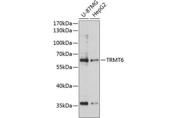TRMT6 Antikörper  (AA 1-200)