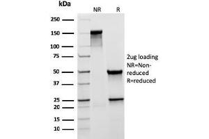 SDS-PAGE Analysis Purified MUC5AC Recombinant Mouse Monoclonal Antibody (rMUC5AC/3779). (Rekombinanter MUC5AC Antikörper)