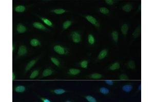 Immunofluorescence analysis of U-2 OS cells using LBR Polyclonal Antibody at dilution of 1:100 (40x lens). (Lamin B Receptor Antikörper)