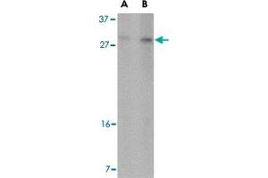 Western blot analysis of DDIT4 in 293 cell lysate with DDIT4 polyclonal antibody  at (A) 2 and (B) 4 ug/mL . (DDIT4 Antikörper  (Internal Region))