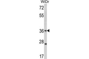 Western Blotting (WB) image for anti-Gap Junction Protein, beta 3, 31kDa (GJB3) antibody (ABIN2998428) (Connexin 31 Antikörper)