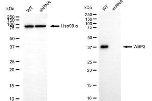 anti-WW Domain Binding Protein 2 (WBP2) antibody