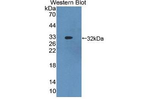 Figure. (ABCB8 Antikörper  (AA 472-735))
