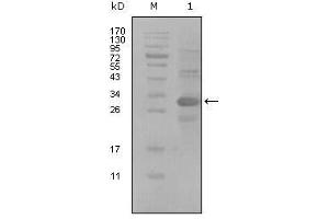 Western blot analysis using ALCAM mouse mAb against truncated Trx-ALCAM recombinant protein (1). (CD166 Antikörper  (AA 405-524))