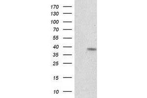 Western Blotting (WB) image for anti-Retinol Dehydrogenase 14 (All-Trans/9-Cis/11-Cis) (RDH14) antibody (ABIN1500657) (RDH14 Antikörper)