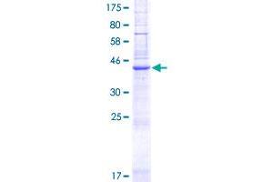 Image no. 1 for PQ Loop Repeat Containing 3 (PQLC3) (AA 1-202) protein (GST tag) (ABIN1316114) (PQLC3 Protein (AA 1-202) (GST tag))