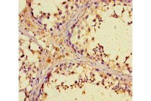 Immunohistochemistry of paraffin-embedded human testis tissue using ABIN7176469 at dilution of 1:100 (ZNF662 Antikörper  (AA 182-452))
