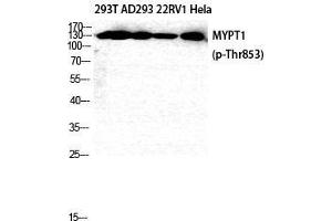 Western Blot (WB) analysis of 293T AD293 22RV1 HeLa cells using Phospho-MYPT1 (T853) Polyclonal Antibody. (PPP1R12A Antikörper  (pThr853))
