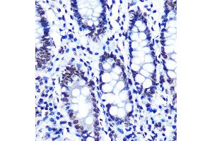 Immunohistochemistry of paraffin-embedded human colon using Phospho-SMC1-S957 Rabbit mAb (ABIN7270613) at dilution of 1:100 (40x lens). (SMC1A Antikörper  (pSer957))