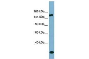 Image no. 1 for anti-Glutamyl-Prolyl-tRNA Synthetase (EPRS) (AA 971-1020) antibody (ABIN6741867) (EPRS Antikörper  (AA 971-1020))