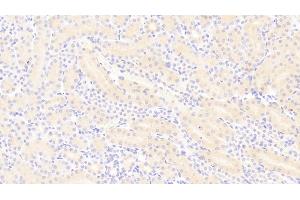 Detection of PDGF BB in Mouse Kidney Tissue using Polyclonal Antibody to Platelet Derived Growth Factor BB (PDGF BB) (PDGF-BB Homodimer (AA 21-241) Antikörper)