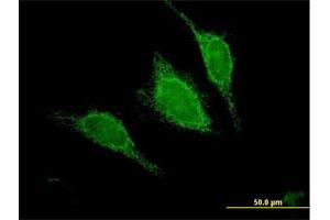 Immunofluorescence of purified MaxPab antibody to ACADM on HeLa cell. (Medium-Chain Specific Acyl-CoA Dehydrogenase, Mitochondrial (AA 1-421) Antikörper)