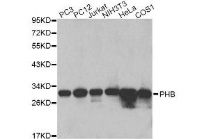 Western blot analysis of extracts of various cell lines, using PHB antibody. (Prohibitin Antikörper  (AA 73-272))