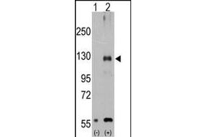 Western blot analysis of TR (arrow) using rabbit polyclonal TR Antibody (Center ) (ABIN392820 and ABIN2842252). (TRPM8 Antikörper  (AA 521-552))