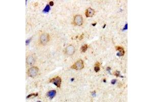 Immunohistochemical analysis of MYPT1 staining in human brain formalin fixed paraffin embedded tissue section. (PPP1R12A Antikörper)