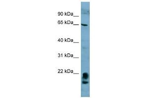 FAM134A antibody used at 1 ug/ml to detect target protein. (FAM134A Antikörper  (N-Term))