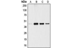 Western blot analysis of ANGPTL4 expression in A549 (A), 293T (B), U87MG (C), SGC (D) whole cell lysates. (ANGPTL4 Antikörper  (Center))