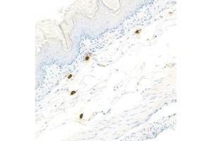 Immunohistochemistry analysis of paraffin-embedded mouseskinusing Chymase (ABIN7073506) at dilution of 1:1000 (CMA1 Antikörper)