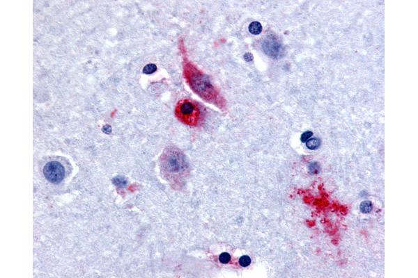 GPR61 Antikörper  (Extracellular Domain)