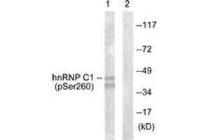 Western blot analysis of extracts from 293 cells treated with H2O2 100uM 15', using hnRNP C1/2 (Phospho-Ser260) Antibody. (HNRNPC Antikörper  (pSer260))