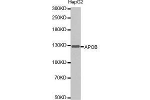 Western blot analysis of extracts of HepG2 cells lines, using APOB antibody. (APOB Antikörper  (AA 28-330))