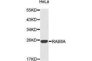 Western blot analysis of extracts of HeLa cells, using RAB8A antibody (ABIN3049334). (RAB8A Antikörper)