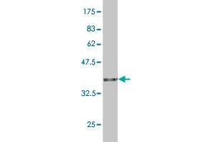 Western Blotting (WB) image for anti-Ribosomal Protein S5 (RPS5) (AA 106-204) antibody (ABIN519885)