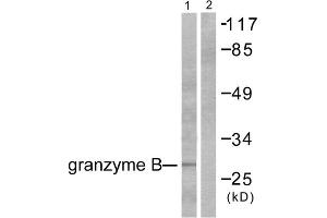 Western blot analysis of extracts from NIH/3T3 cells, using Granzyme B antibody (ABIN2843546). (GZMB Antikörper  (N-Term))
