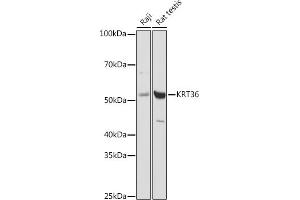 Western blot analysis of extracts of various cell lines, using (ABIN6130229, ABIN6143029, ABIN6143030 and ABIN6217868) at 1:1000 dilution. (Keratin 36 Antikörper  (AA 388-467))