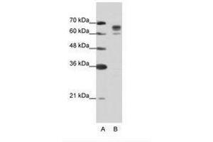 Image no. 2 for anti-DEAD (Asp-Glu-Ala-Asp) Box Polypeptide 17 (DDX17) (AA 570-619) antibody (ABIN203205) (DDX17 Antikörper  (AA 570-619))