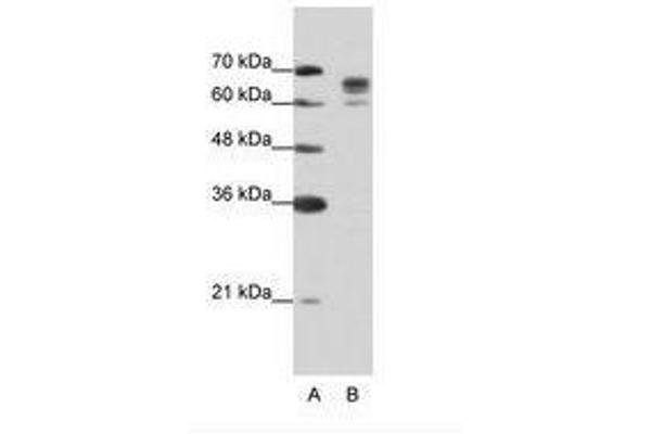 DDX17 抗体  (AA 570-619)