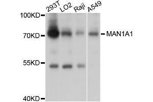 Western blot analysis of extracts of various cell lines, using MAN1A1 antibody (ABIN5998162) at 1/1000 dilution.