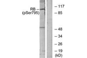 Western blot analysis of extracts from K562 cells treated with serum 10%, using Retinoblastoma (Phospho-Ser795) Antibody.