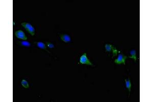 Immunofluorescent analysis of 293 cells using ABIN7172868 at dilution of 1:100 and Alexa Fluor 488-congugated AffiniPure Goat Anti-Rabbit IgG(H+L) (TRPM6 Antikörper  (AA 740-840))