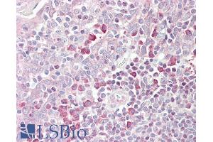 Immunohistochemistry (IHC) image for anti-Membrane-Associated Ring Finger (C3HC4) 6, E3 Ubiquitin Protein Ligase (MARCH6) (Internal Region) antibody (ABIN238603)