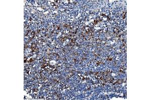 IHC analysis of Liver Carboxylesterase 1/CES1 using anti-Liver Carboxylesterase 1/CES1 antibody (ABIN7602719). (CES1 Antikörper  (AA 99-206))