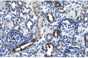 Human kidney; TSFM antibody - N-terminal region in Human kidney cells using Immunohistochemistry (TSFM Antikörper  (N-Term))