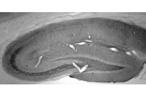 Adult rat hippocampus immunohistochemistry.