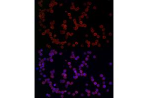 Immunofluorescence analysis of THP-1 cells using YKL-40/CHI3L1 Rabbit pAb (ABIN1679214, ABIN1679215, ABIN1679216, ABIN5664234 and ABIN6220124) at dilution of 1:50 (40x lens). (CHI3L1 Antikörper  (AA 22-240))