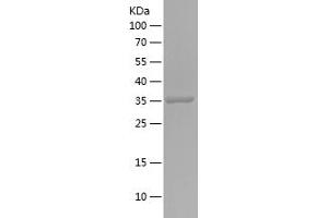 ADH5 Protein (AA 258-374) (His-IF2DI Tag)