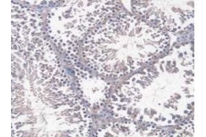 Immunohistochemistry (IHC) image for anti-DnaJ (Hsp40) Homolog, Subfamily C, Member 2 (DNAJC2) (AA 368-621) antibody (ABIN7444604)