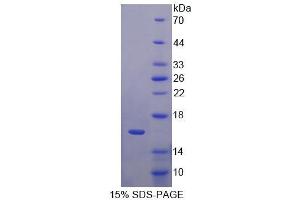 SDS-PAGE (SDS) image for Growth Differentiation Factor 11 (GDF11) (AA 299-407) protein (His tag) (ABIN6238884) (GDF11 Protein (AA 299-407) (His tag))