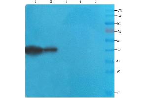Western Blot using anti-CDCrel-1 antibody ABIN7072252 Rat brain (lane 1), mouse spinal cord (lane 2), rat testis (lane 3), human lung cancer (lane 4) and human breast cancer (lane 5) samples were resolved on a 12 % SDS PAGE gel and blots probed with ABIN7072252 at 2 μg/mL before being detected by a secondary antibody.