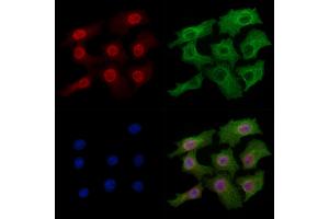 Phospho-TOP2A (Thr1343) Antibody staining Hela cells(heat shock treatment) by IF/ICC.