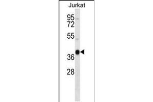 Western blot analysis in Jurkat cell line lysates (35ug/lane). (MARCH4 Antikörper  (C-Term))