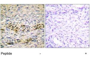 Immunohistochemistry analysis of paraffin-embedded human ovary tissue using AKT1 polyclonal antibody . (AKT1 Antikörper)