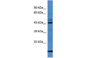 Western Blotting (WB) image for anti-serpin Peptidase Inhibitor, Clade B (Ovalbumin), Member 8 (SERPINB8) (N-Term) antibody (ABIN2774201)